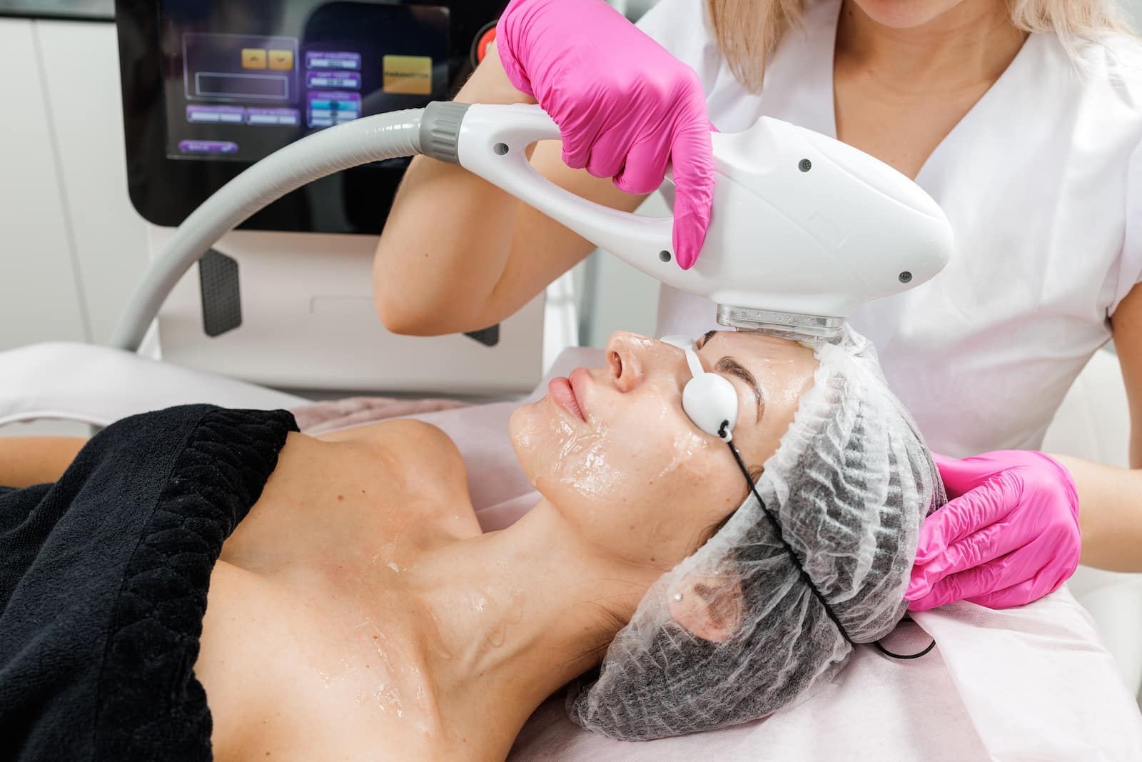 IPL For skin tightening in Nashville